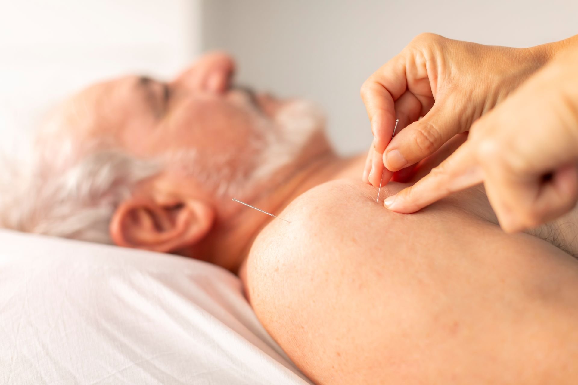 Physiotherapist places needles on the shoulder of an older man